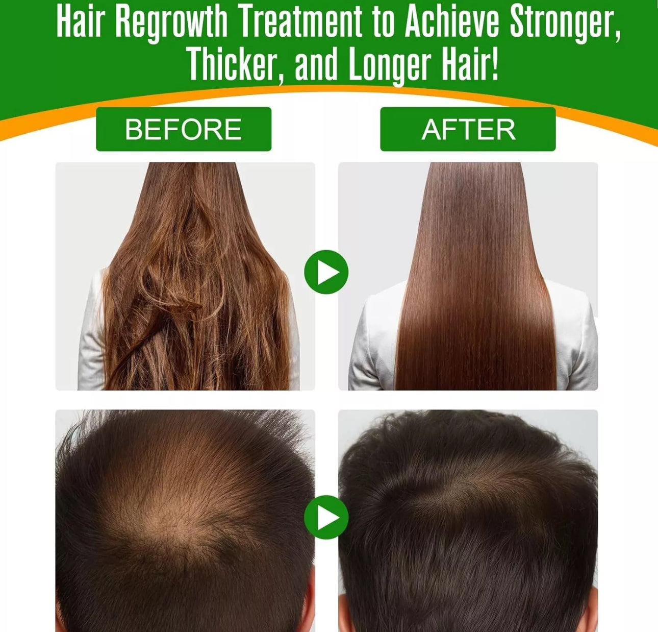 60ml Batana Oil Hair Growth Oil